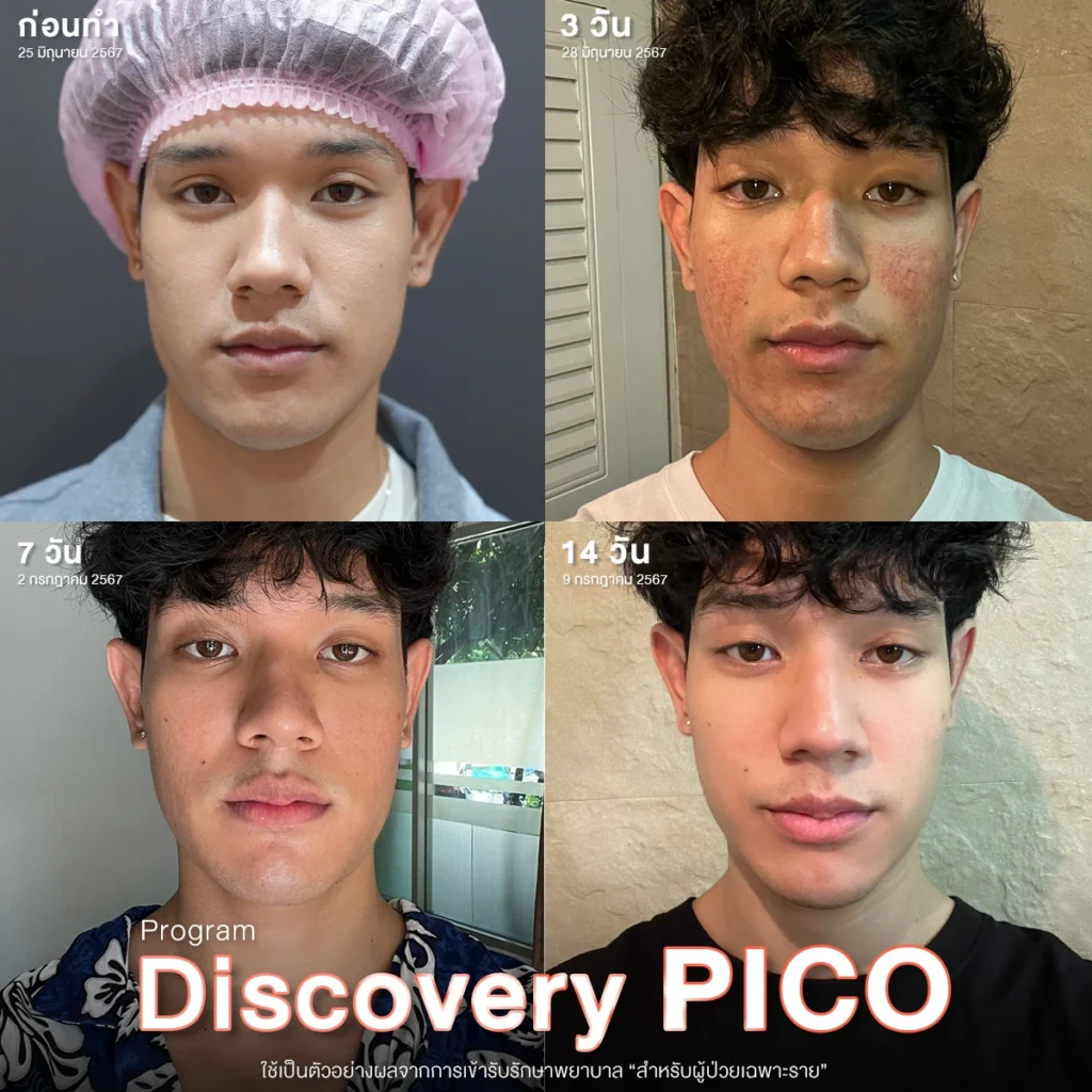 discovery-pico