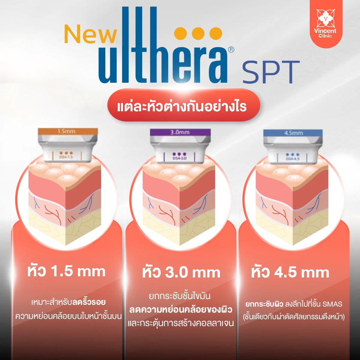 Ulthera SPT แต่ละหัวต่างกันอย่างไร