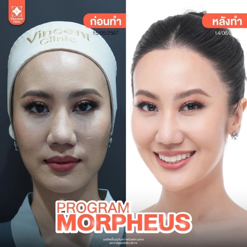 รูปรีวิว