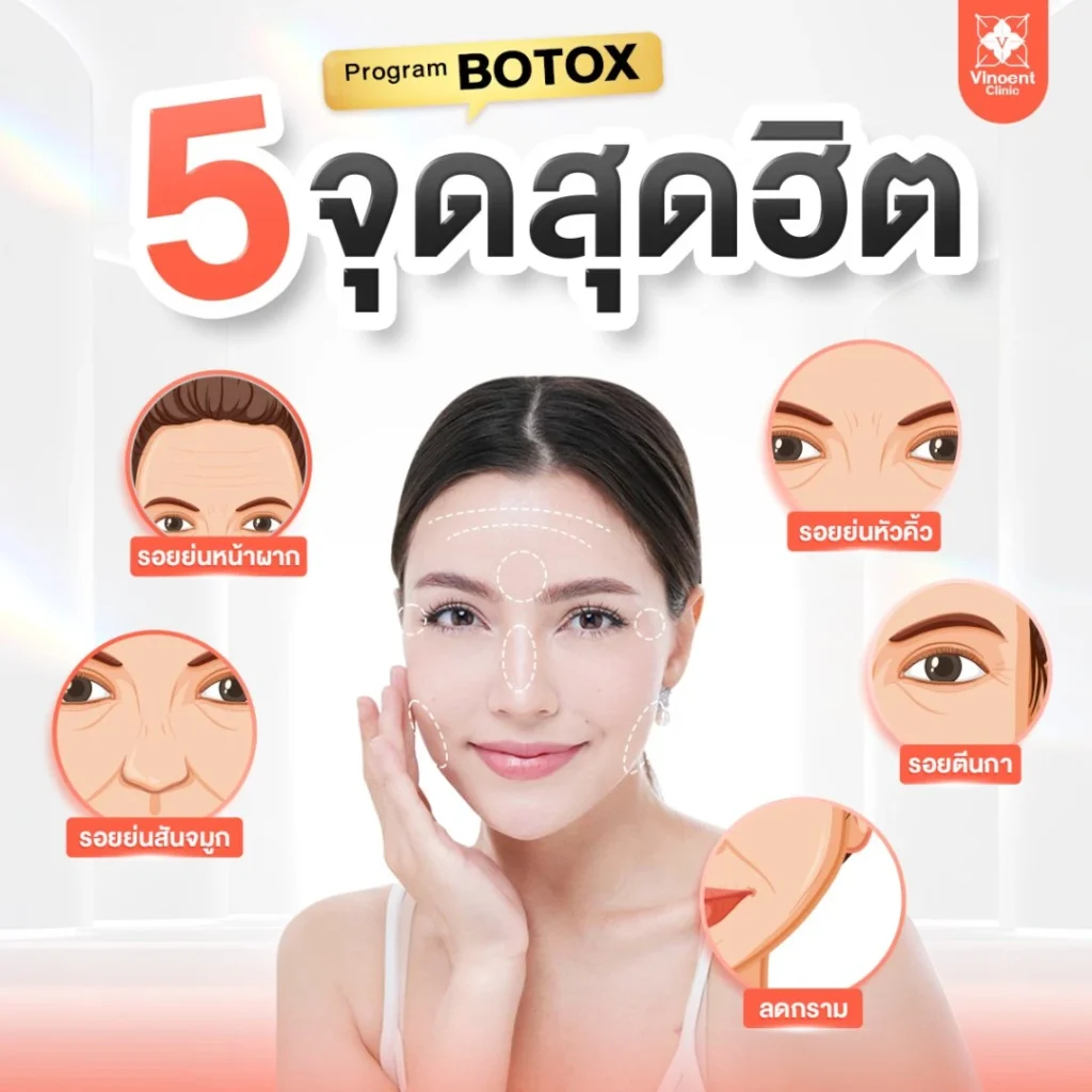 5 จุดฉีด โบท็อก สุดฮิต