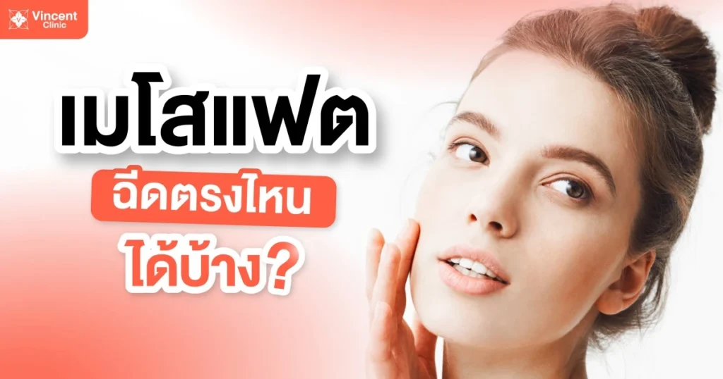 เมโสแฟต ฉีดตรงไหนได้บ้าง?