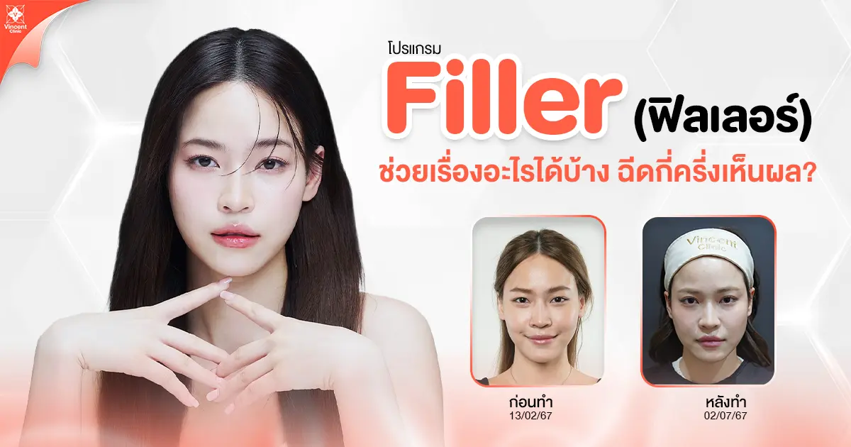 ฟิลเลอร์ ช่วยเรื่องอะไรบ้าง