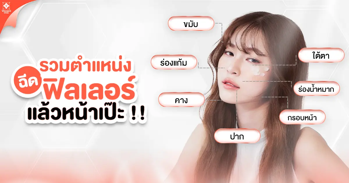 รวมตำแหน่ง ฉีดฟิลเลอร์ หน้าเป๊ะ