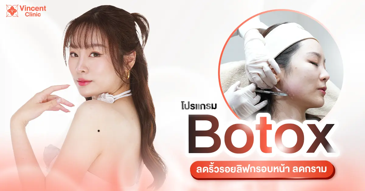 โปรแกรม โบท็อก (botox) ลดริ้วรอย