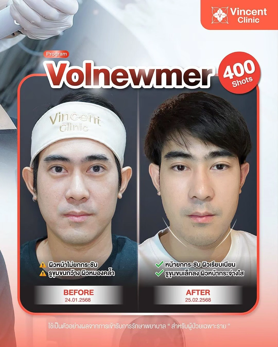 ReviewVolnewmer