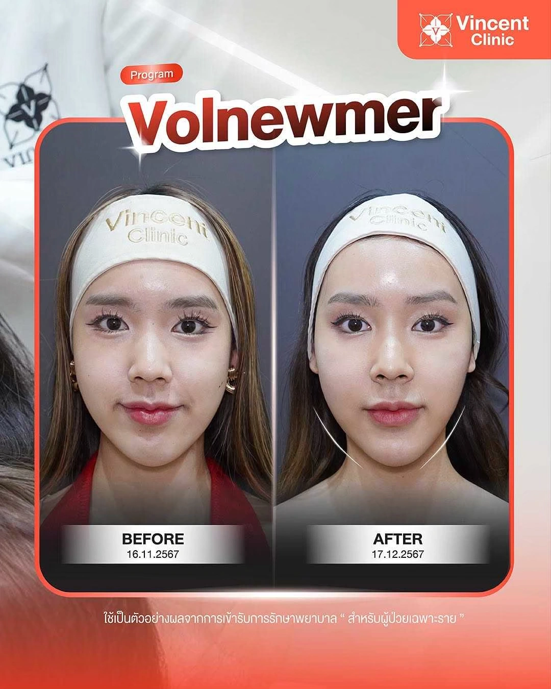ReviewVolnewmerP
