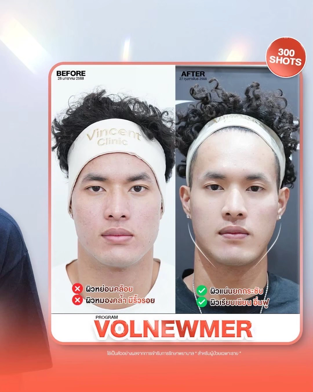 ReviewVolnewmerU