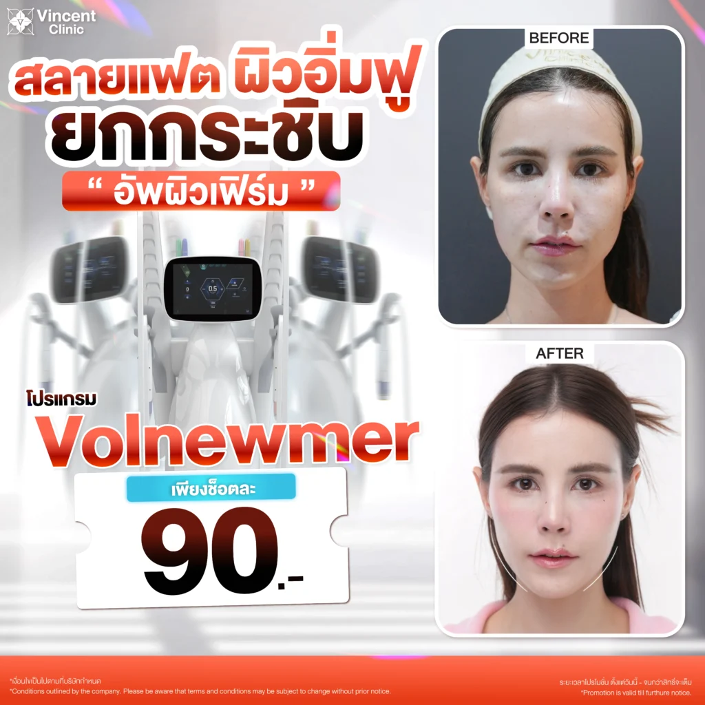 VolnewmerPro