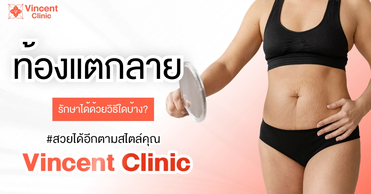 Stretch-Mark ท้อง