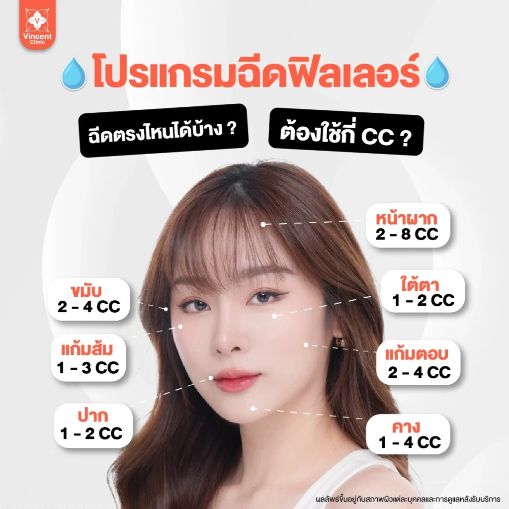 โปรแกรมฟิลเลอร์ลิฟติ้ง