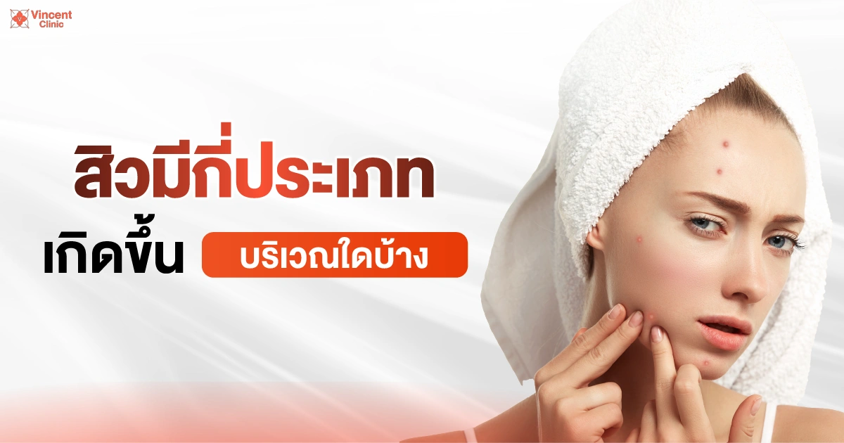 สิว Banner รอยสิว3