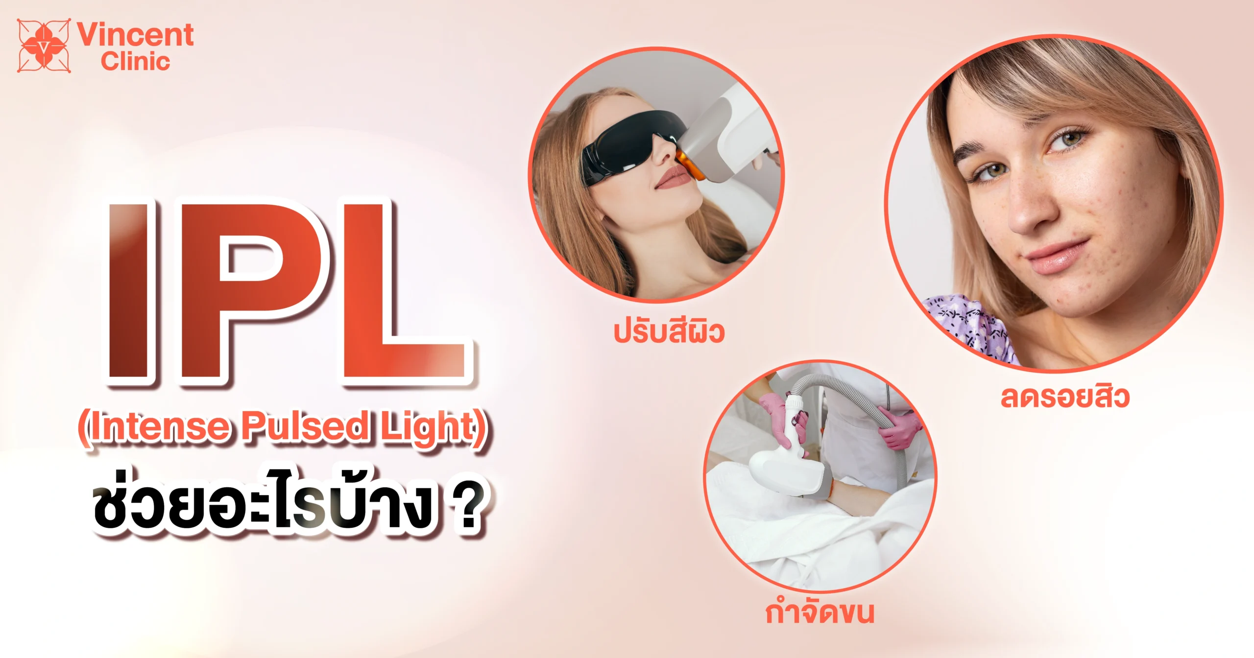 IPLคือ-02