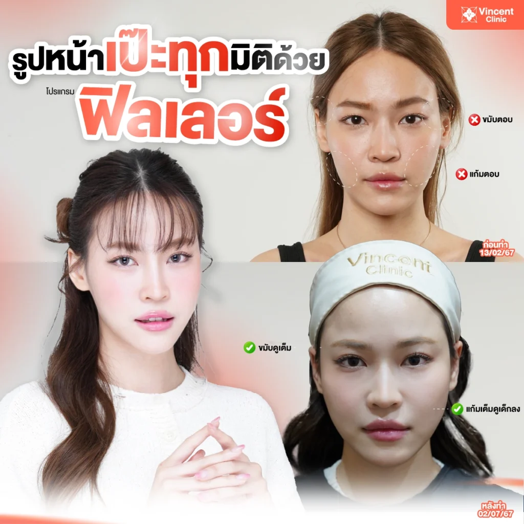 รูปหน้าเป๊ะทุกมิติ