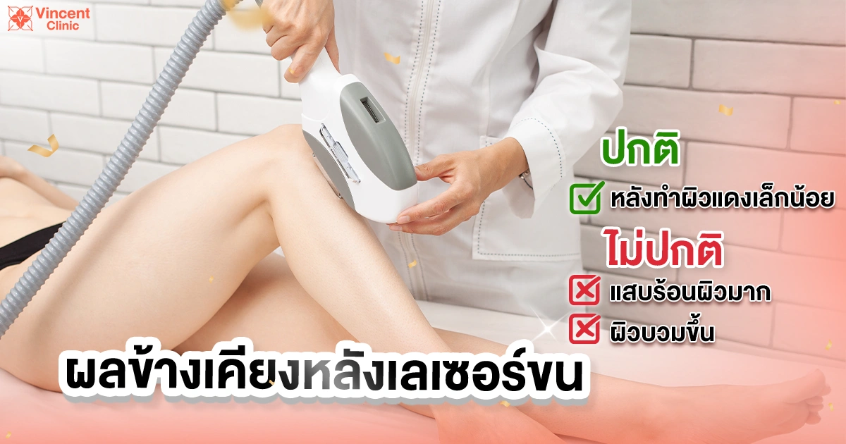 ผลข้างเคียงหลังเลเซอร์ขน