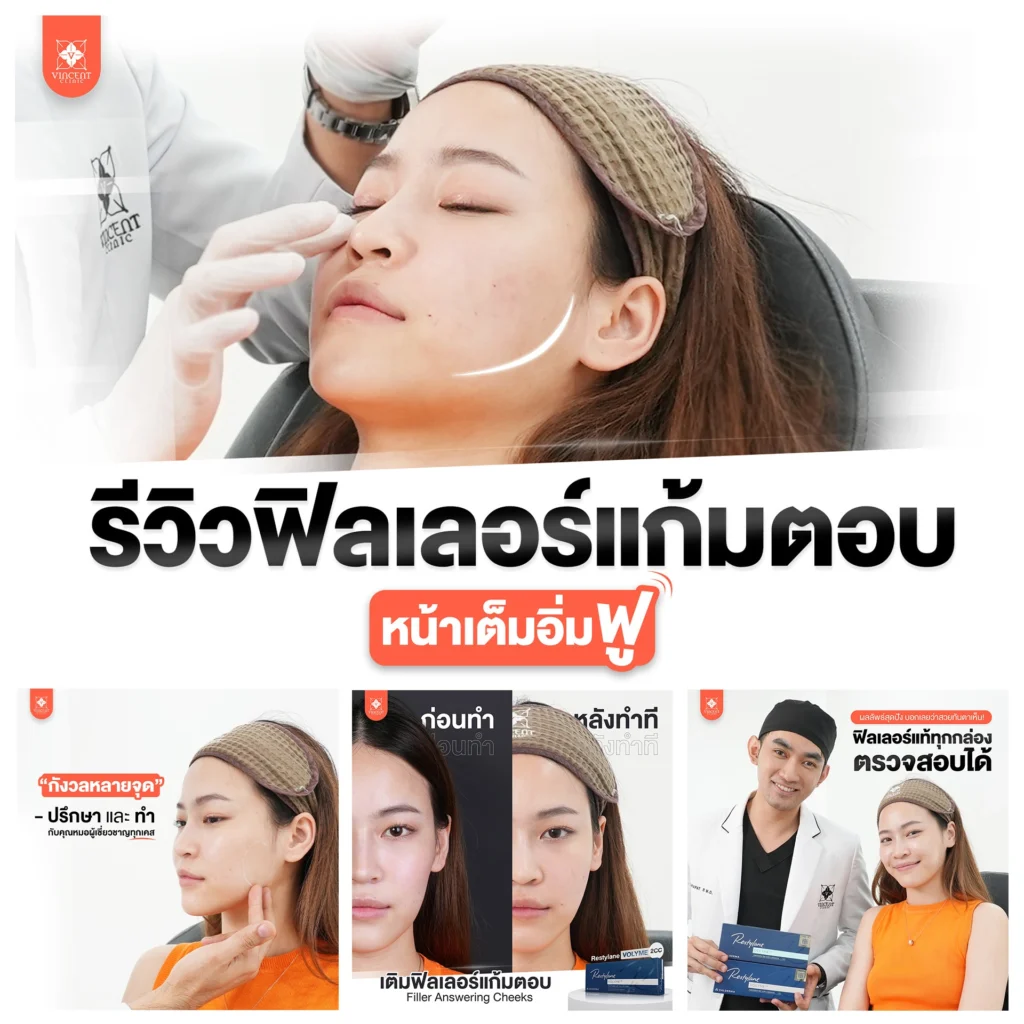 รีวิวฟิลเลอร์แก้มตอบ