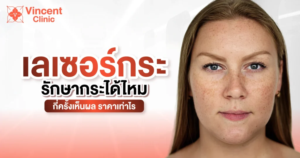 เลเซอร์กระรักษาได้ไหม