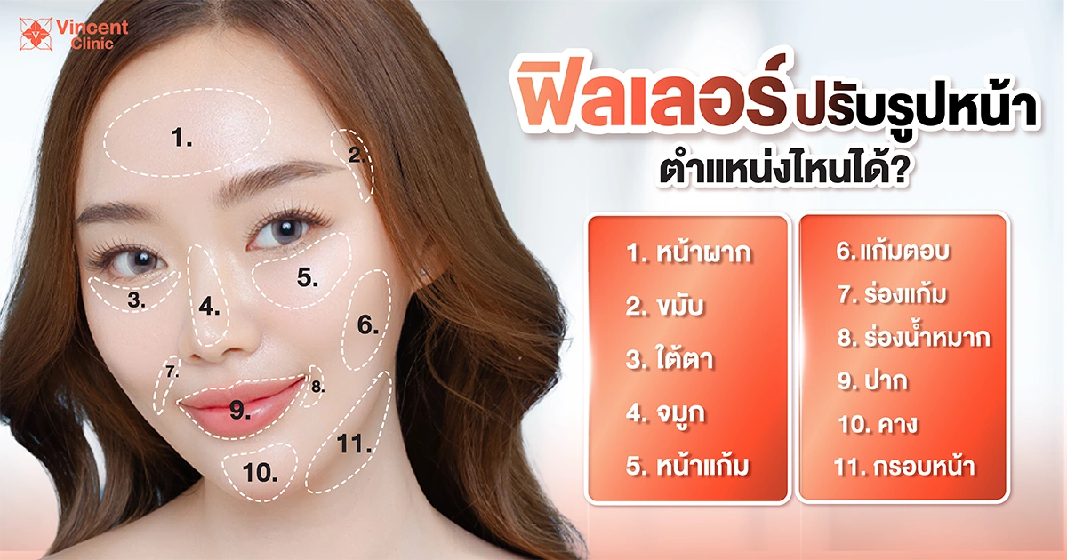 face-filler ฟิลเลอร์ปรับรูปหน้าตำแหน่งไหนได้