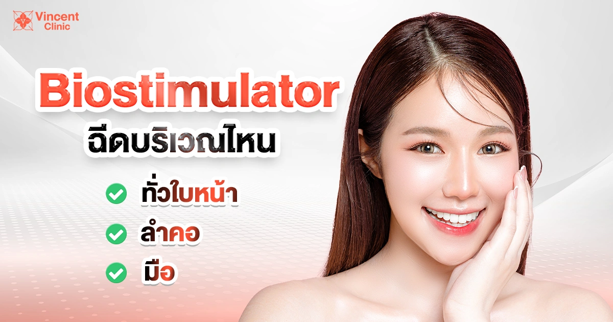 Biostimulator ฉีดบริเวณไหน