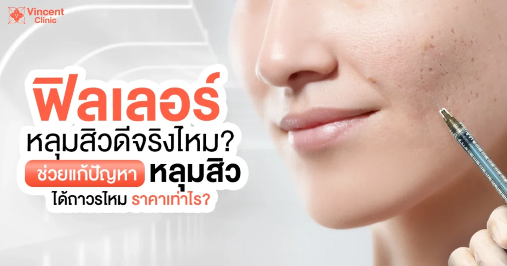 ฟิลเลอร์หลุมสิวดีจริงไหม