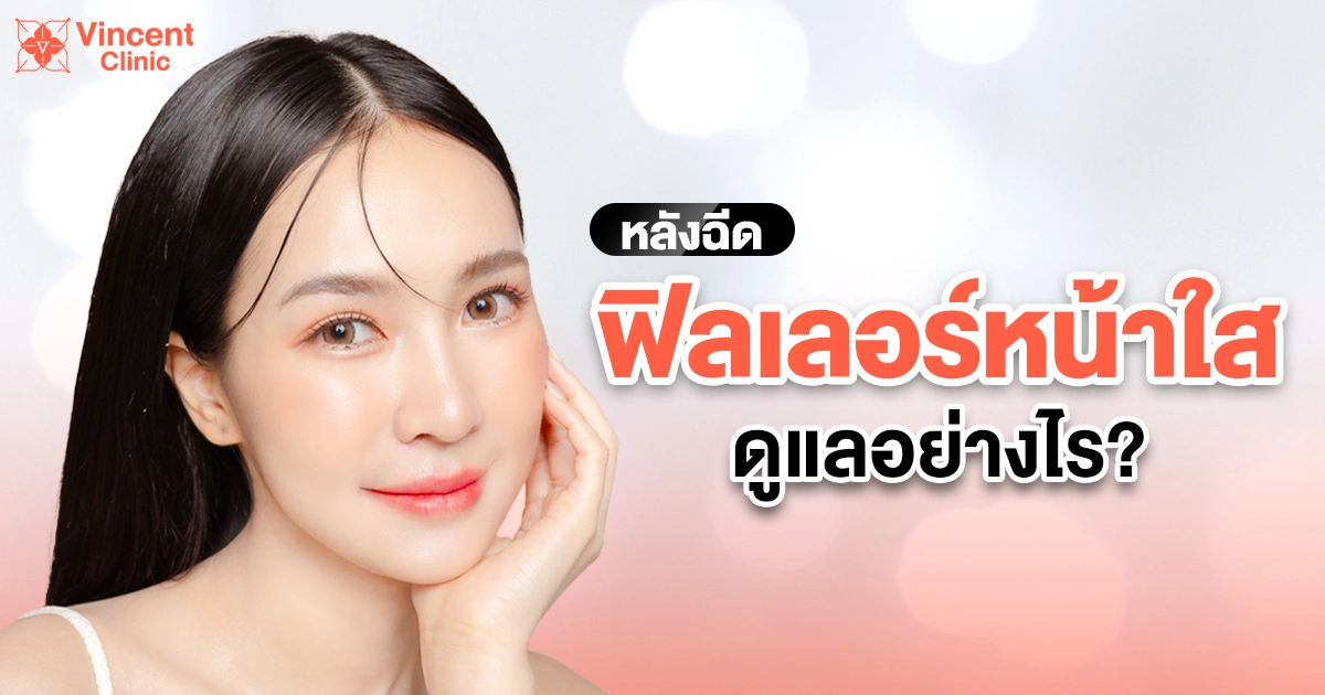ฟิลเลอร์หน้าใสดูแลอย่างไร