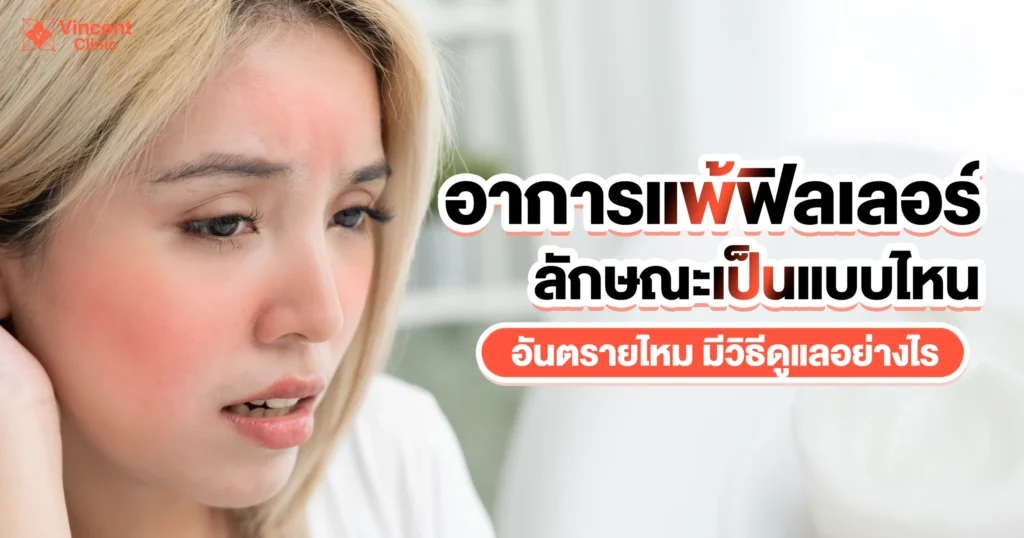 อาการแพ้ฟิลเลอร์ ลักษณะเป็นยังไง