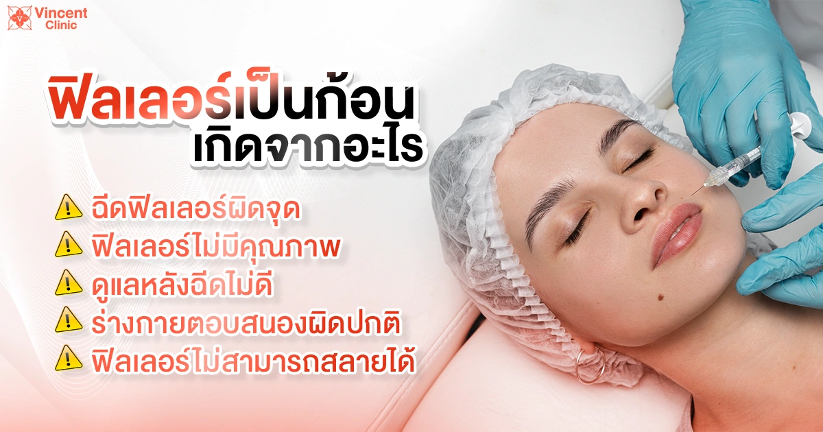 causes the lump filler ฟิลเลอร์เป็นก้อนเกิดจากอะไร