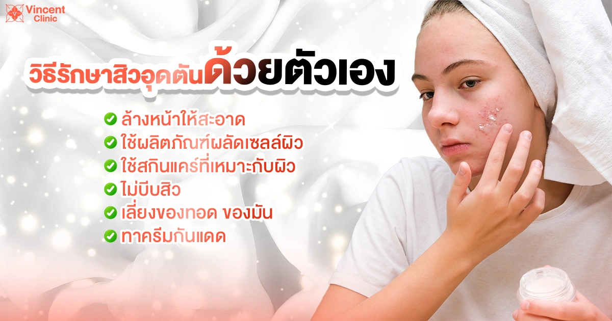 ways to treat comedonal acne วิธีรักษาสิวอุดตัน