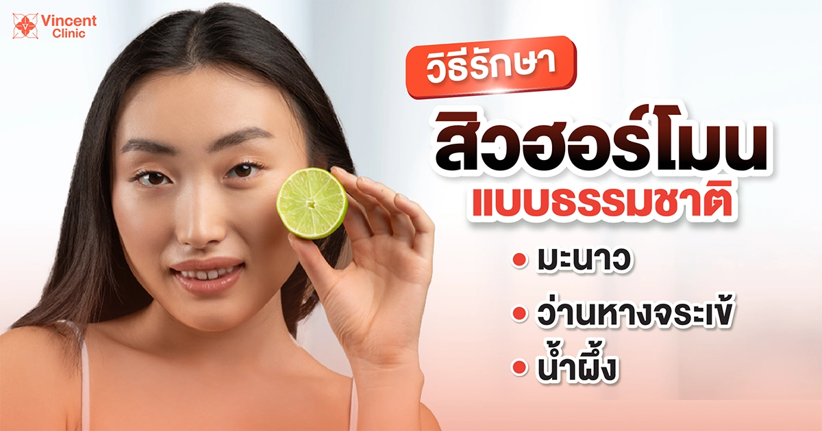 How to treat hormonal acne วิธีรักษาสิวฮอร์โมน