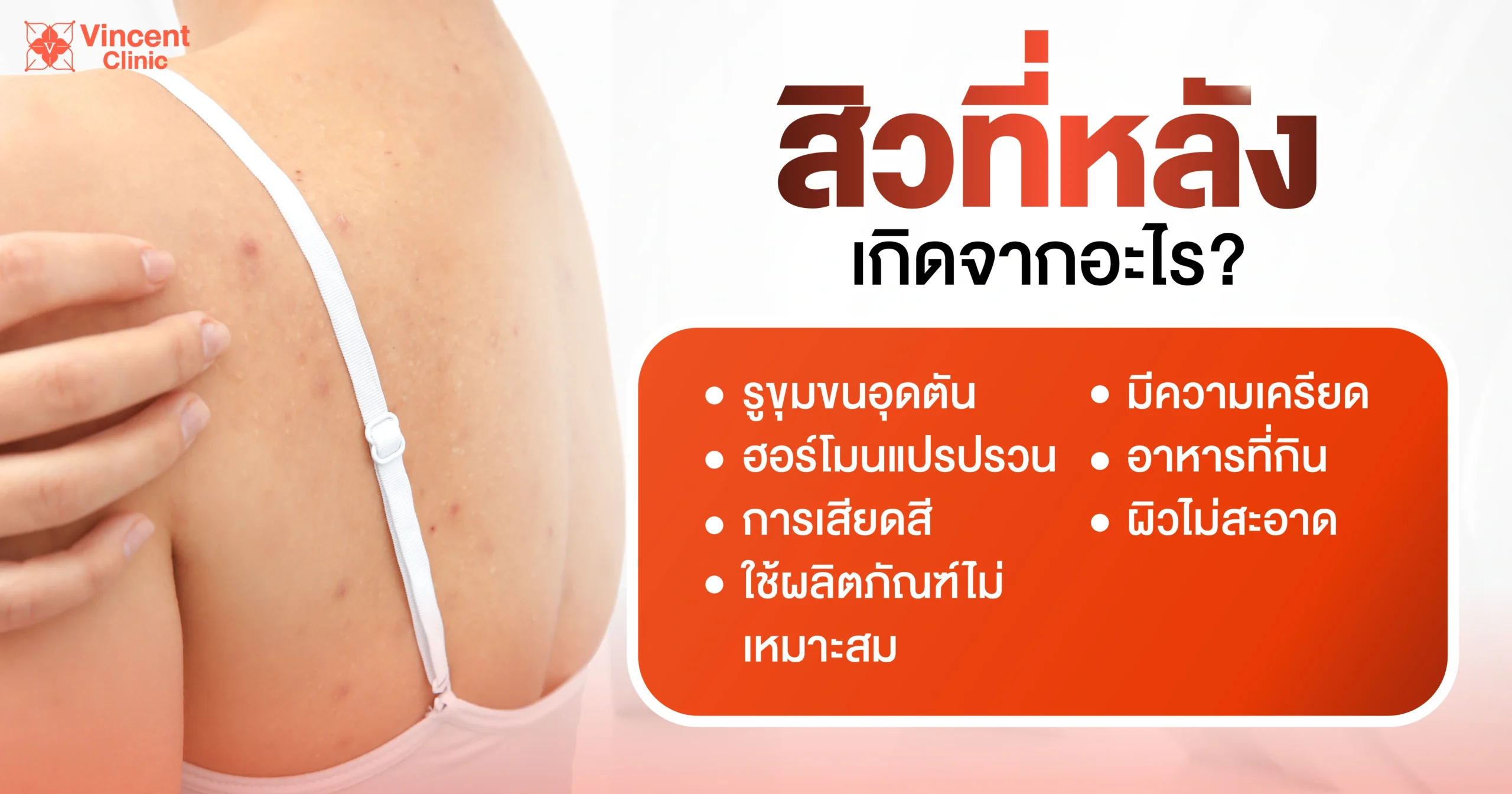 causes of acne on back สาเหตุที่เกิดสิวที่หลัง