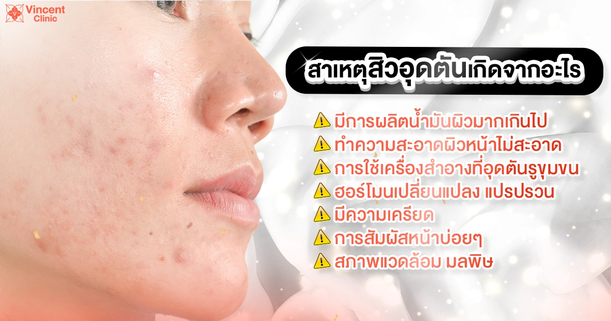 causes of comedonal acne สาเหตุสิวอุดตัน