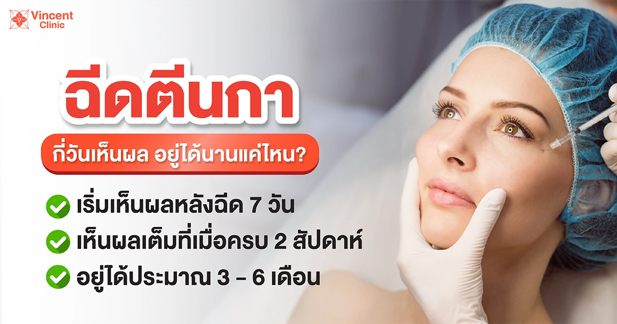 โบท็อกตีนกาอยู่ได้นานแค่ไหน