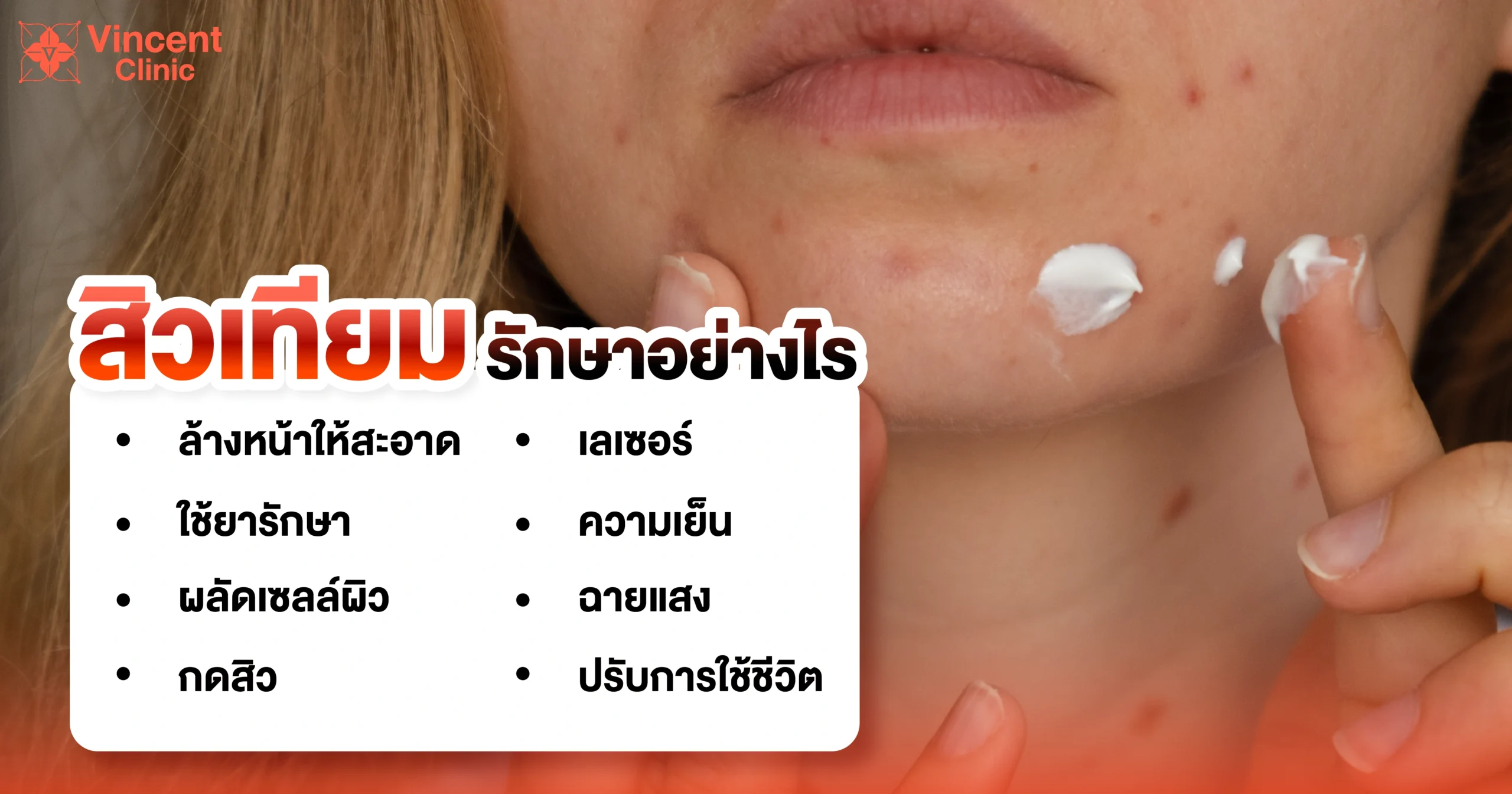 สิวเทียมรักษาอย่างไร