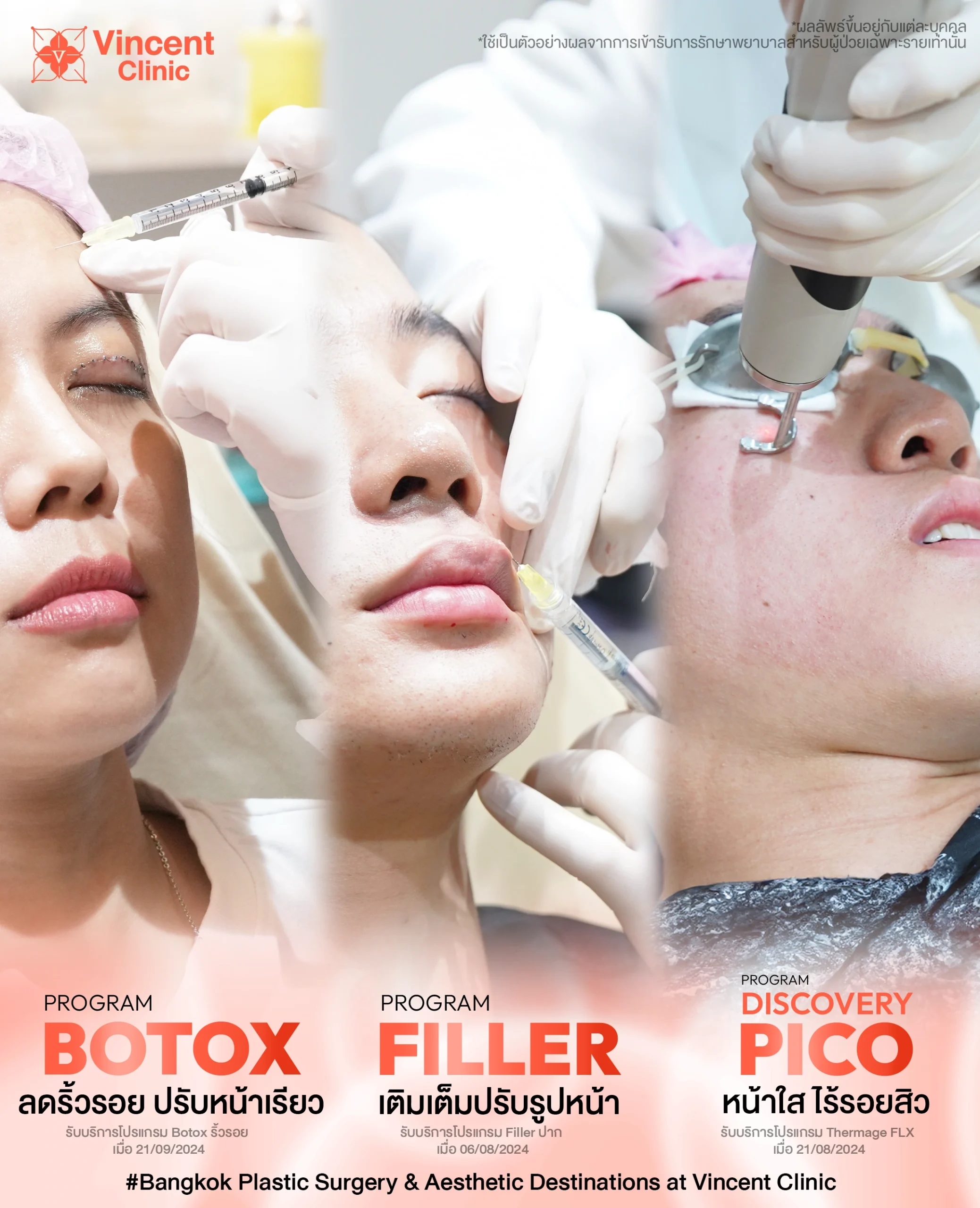 Banner Combined procedures 1