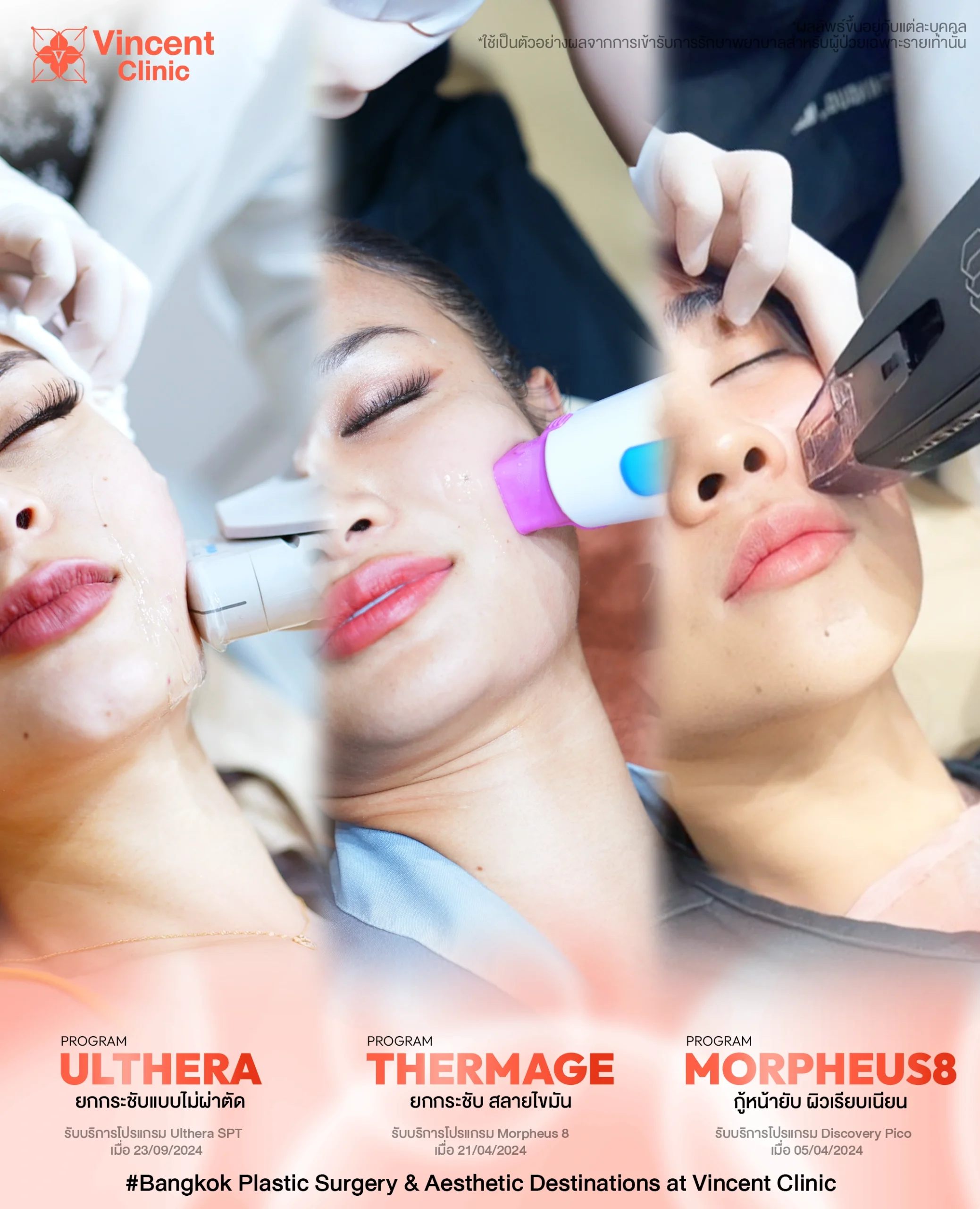 Banner Combined procedures 2