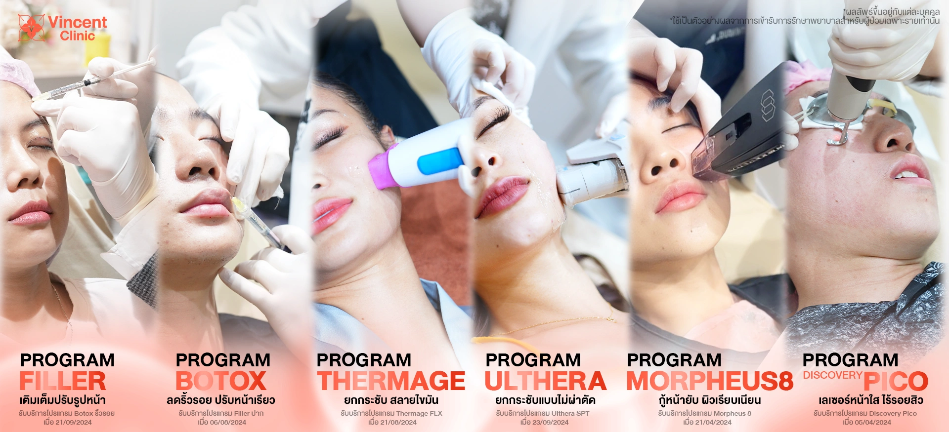 Banner Combined procedures