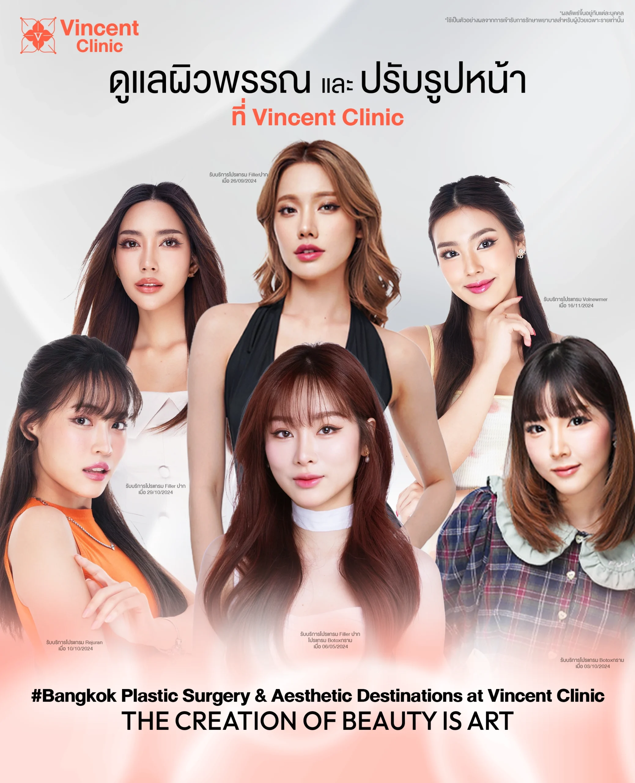 Banner model mb