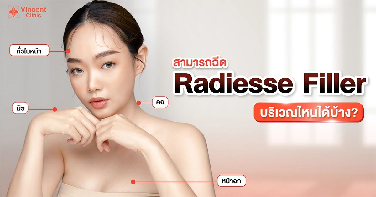 Where can Radiesse be injected Radiesse ฉีดบริเวณไหนได้บ้าง