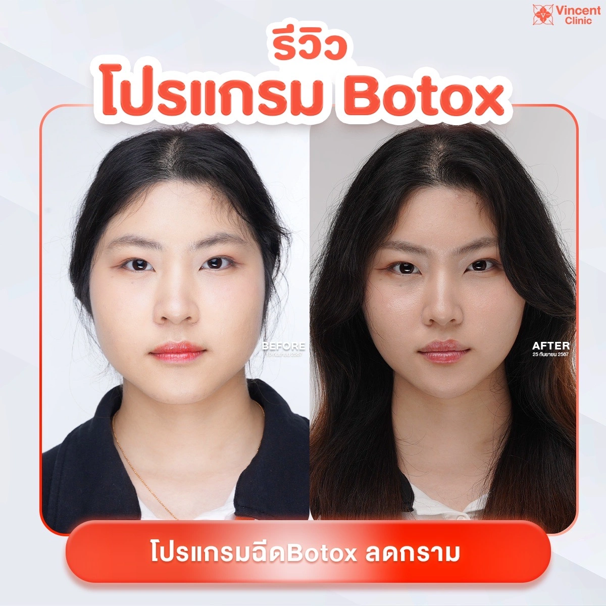 รูปรีวิว