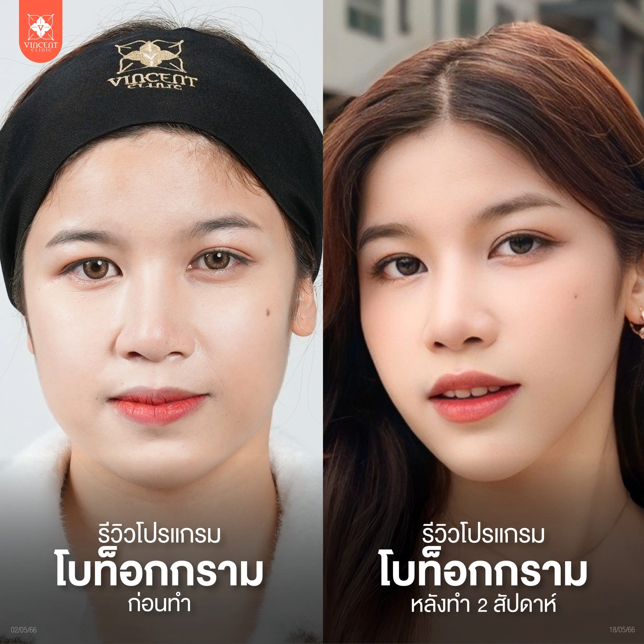 รูปรีวิว