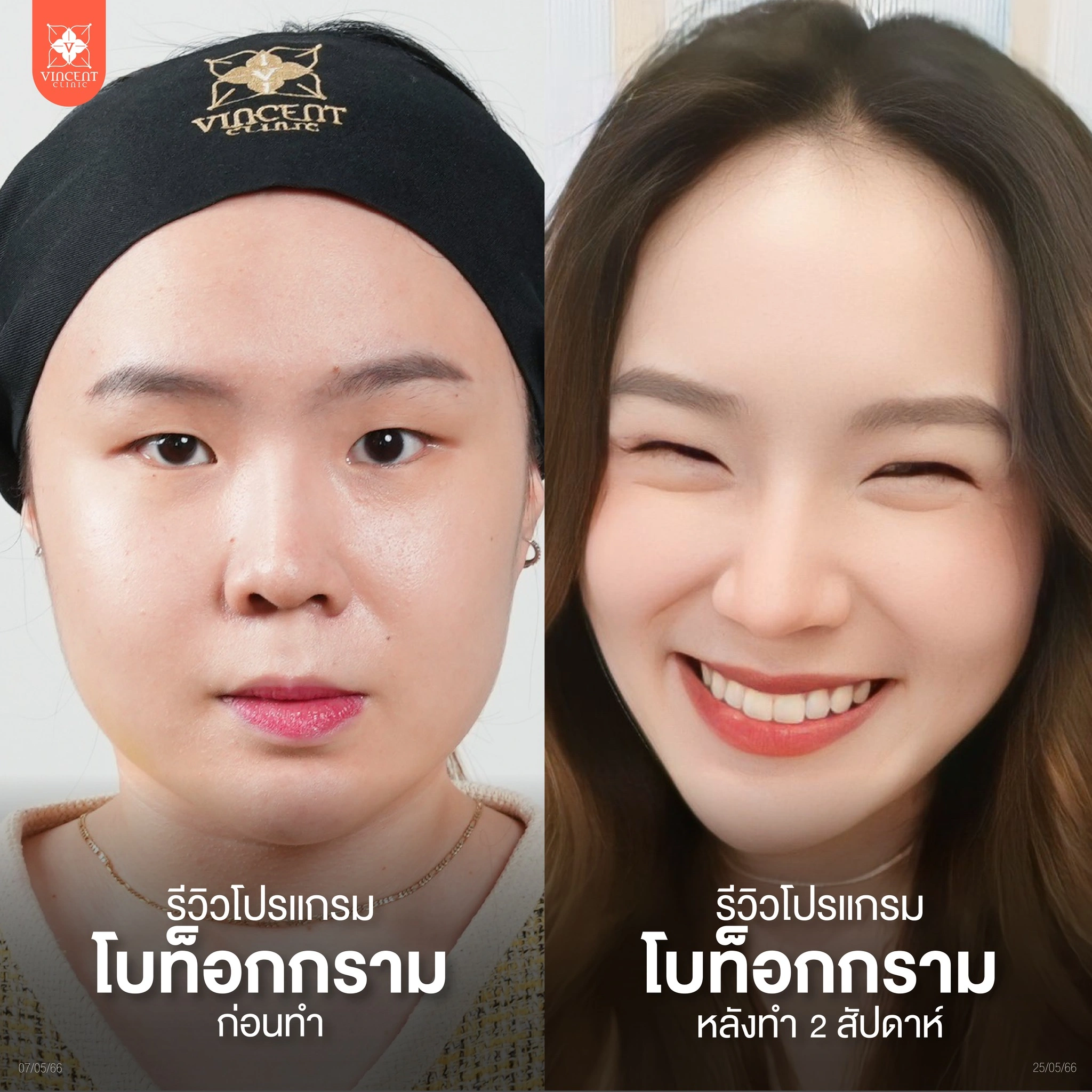รูปรีวิว