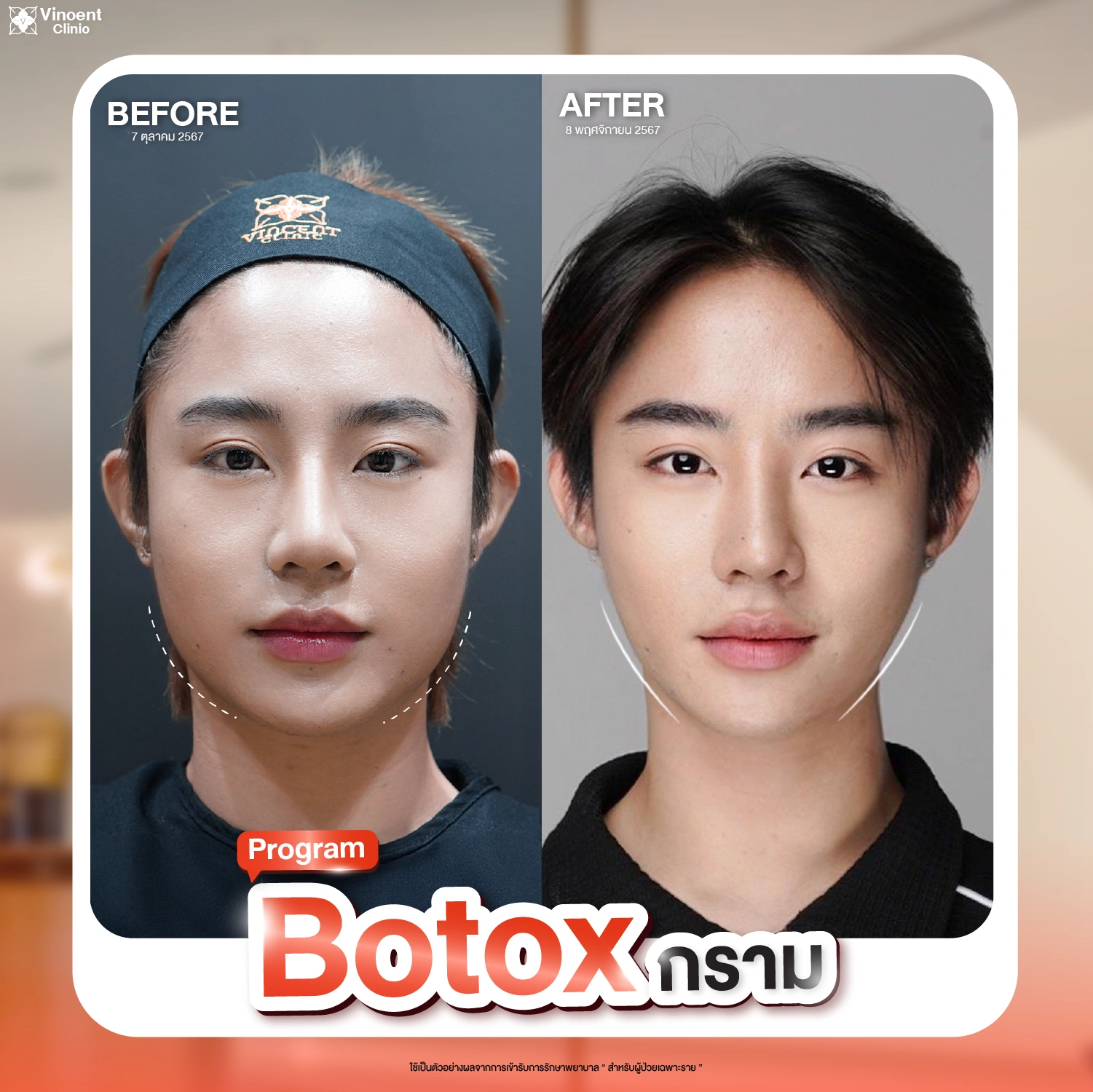 รูปรีวิว
