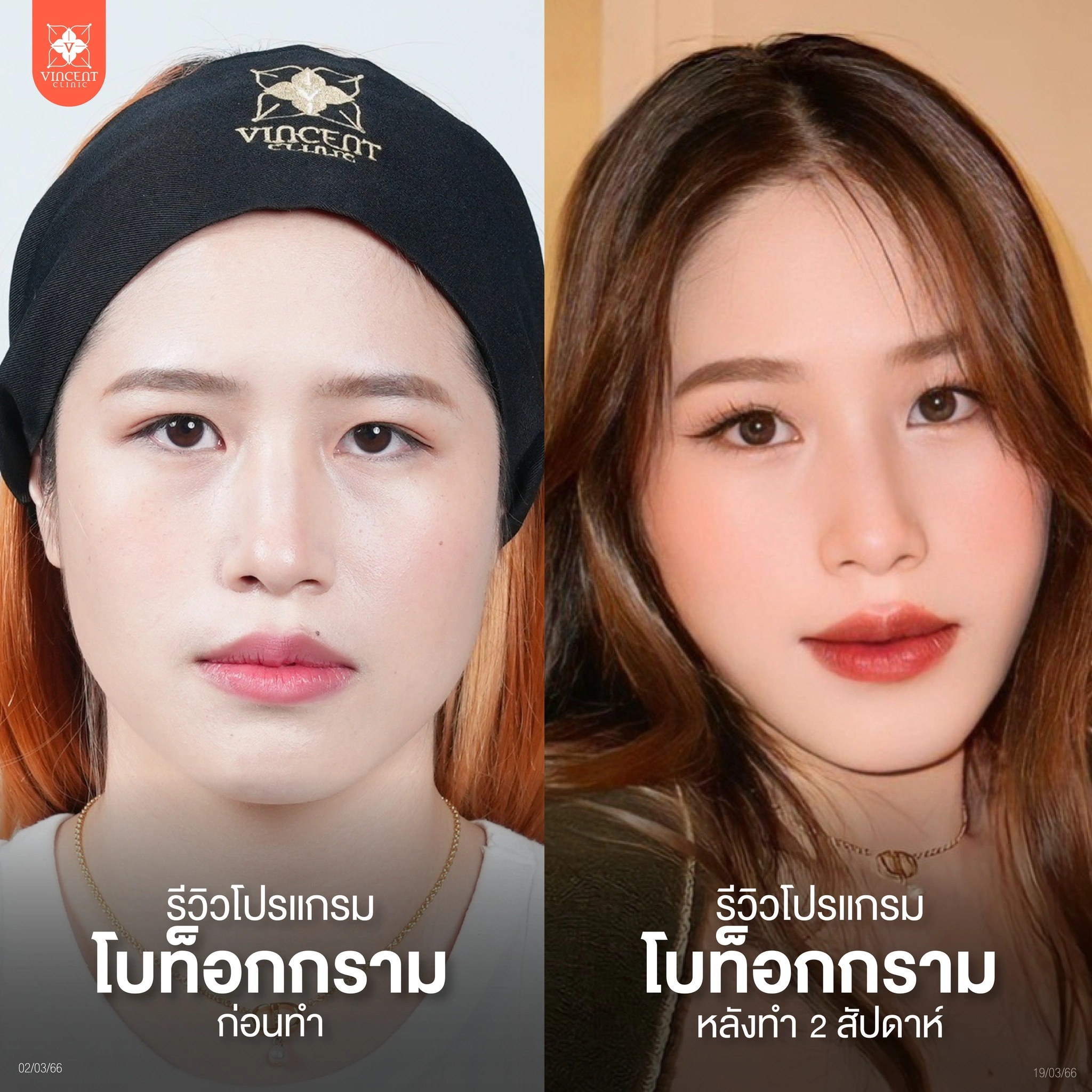 รูปรีวิว