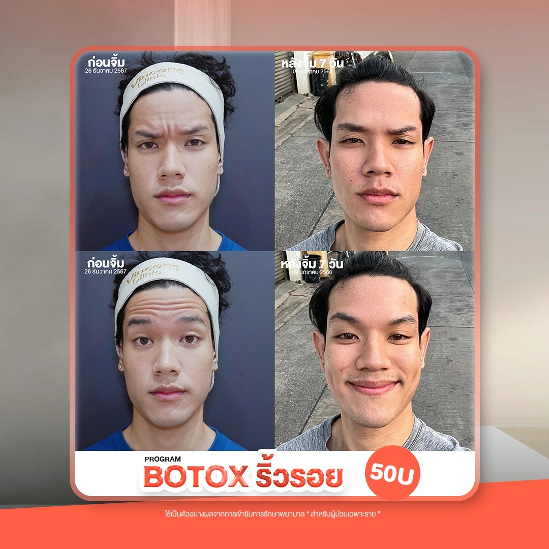 รูปรีวิว