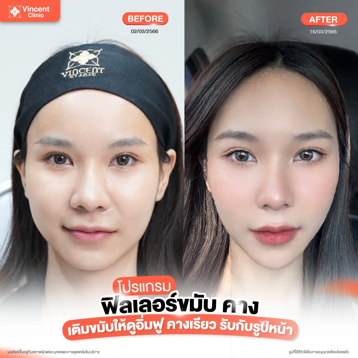 รูปรีวิว