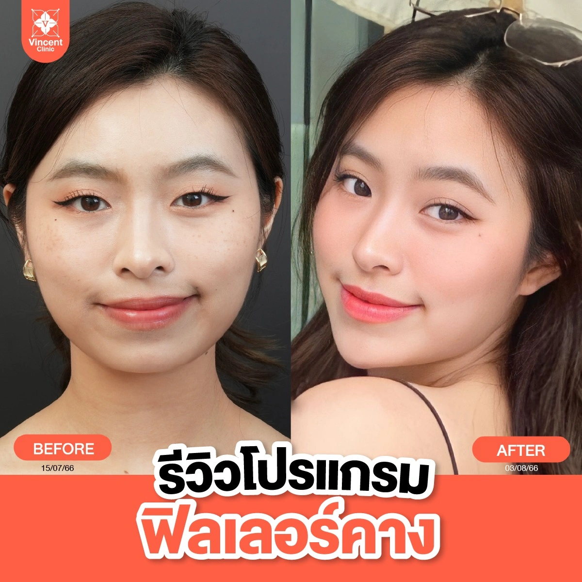 รูปรีวิว