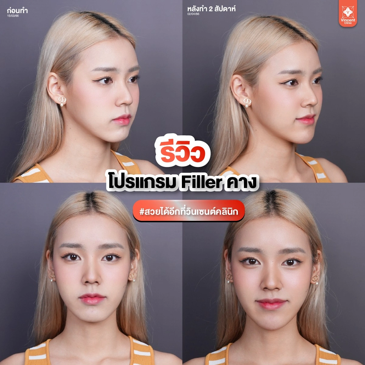 รูปรีวิว