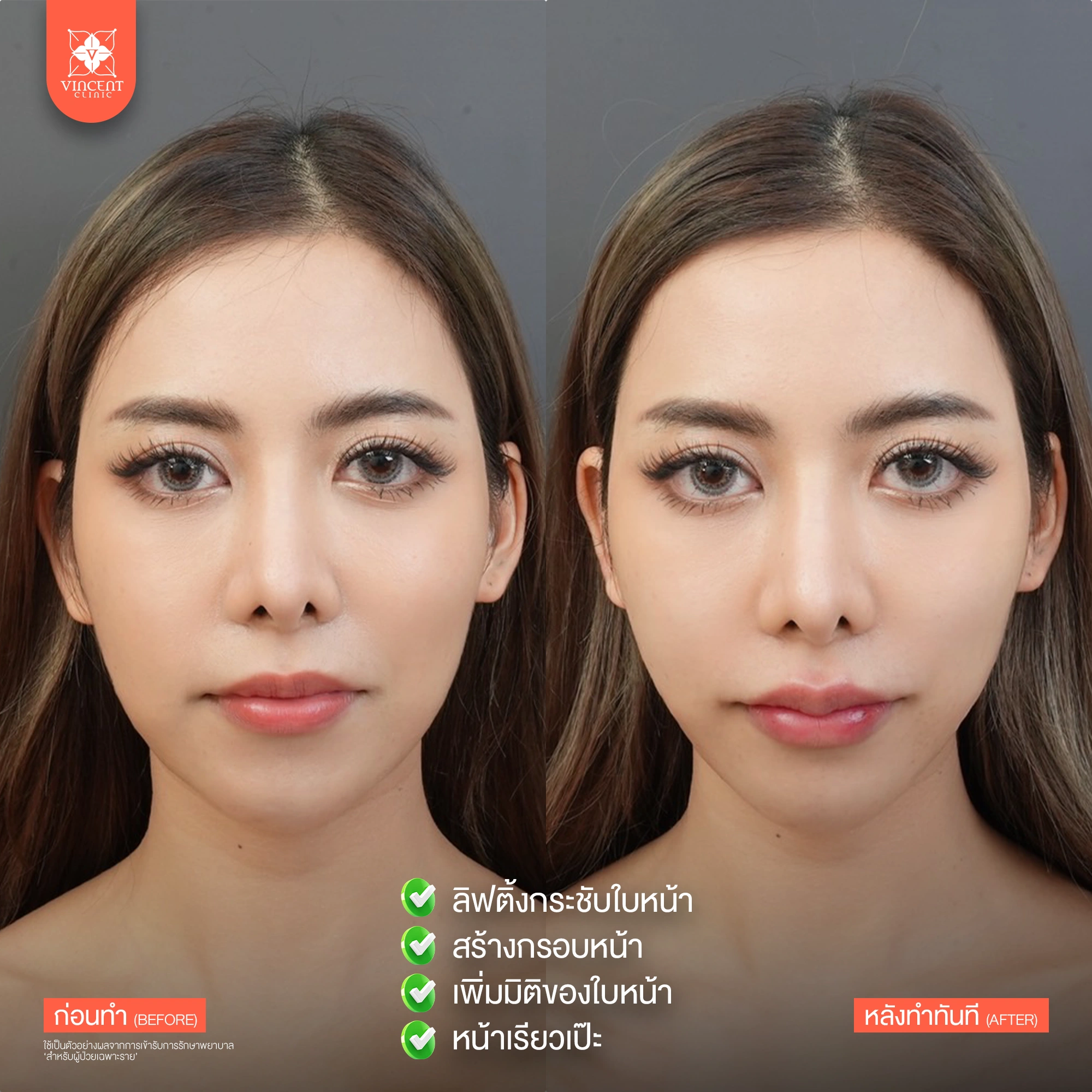 รูปรีวิว