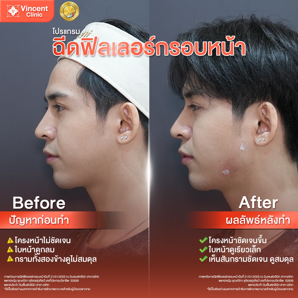 รูปรีวิว