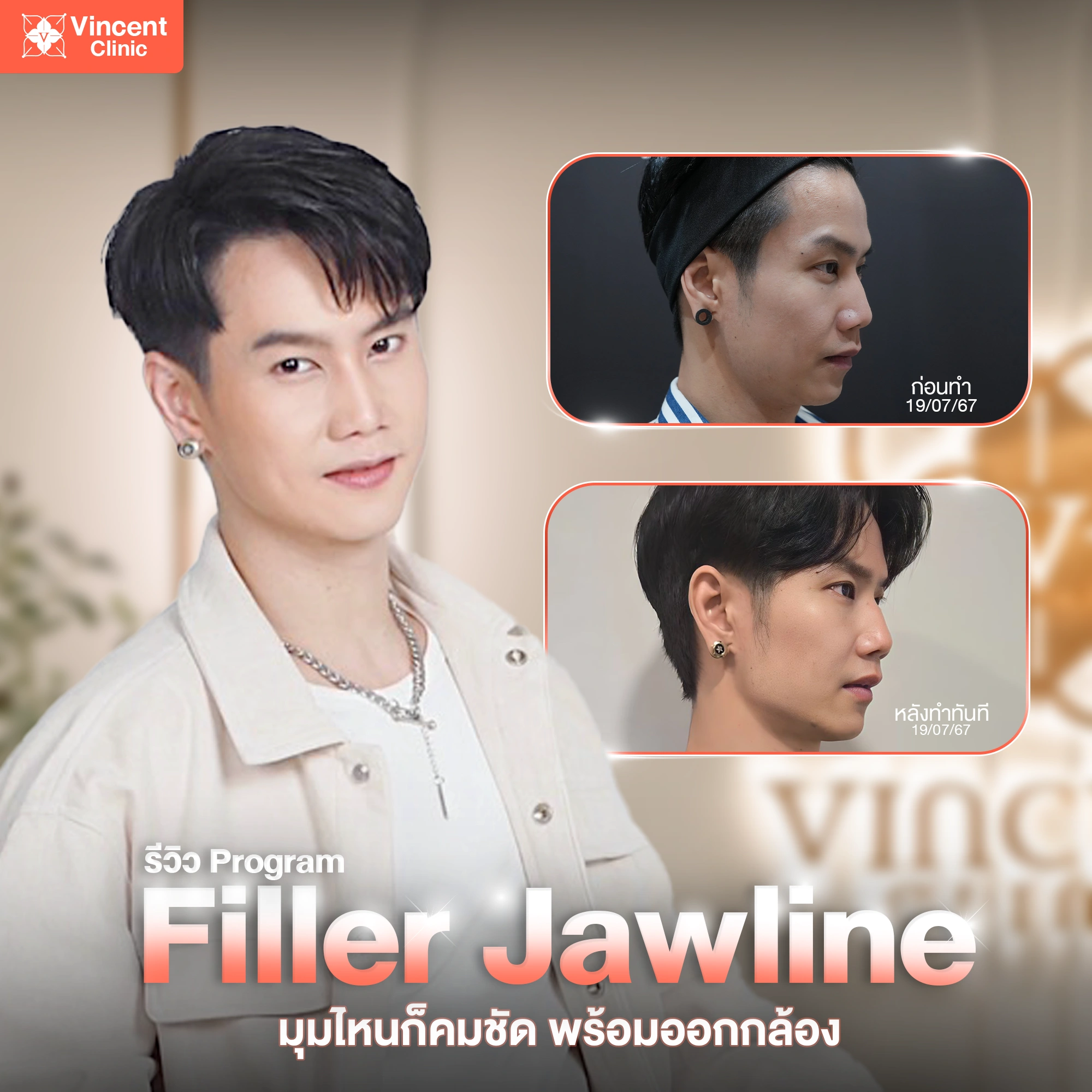 รูปรีวิว