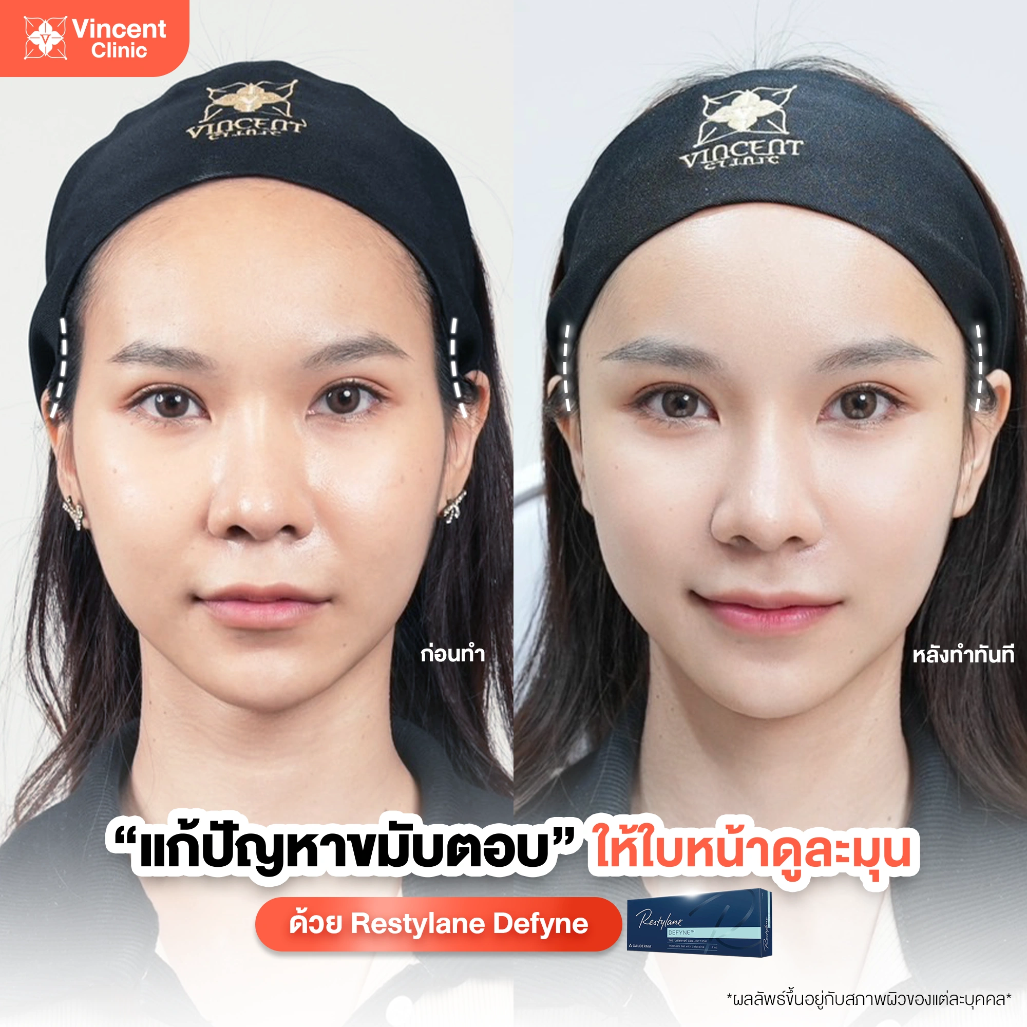 รูปรีวิว